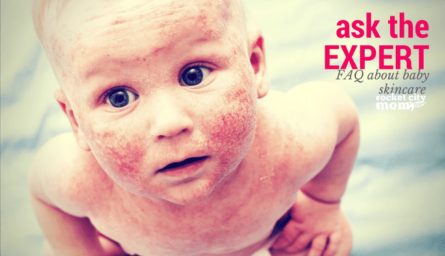 Skincare for Babies: Ask the Expert